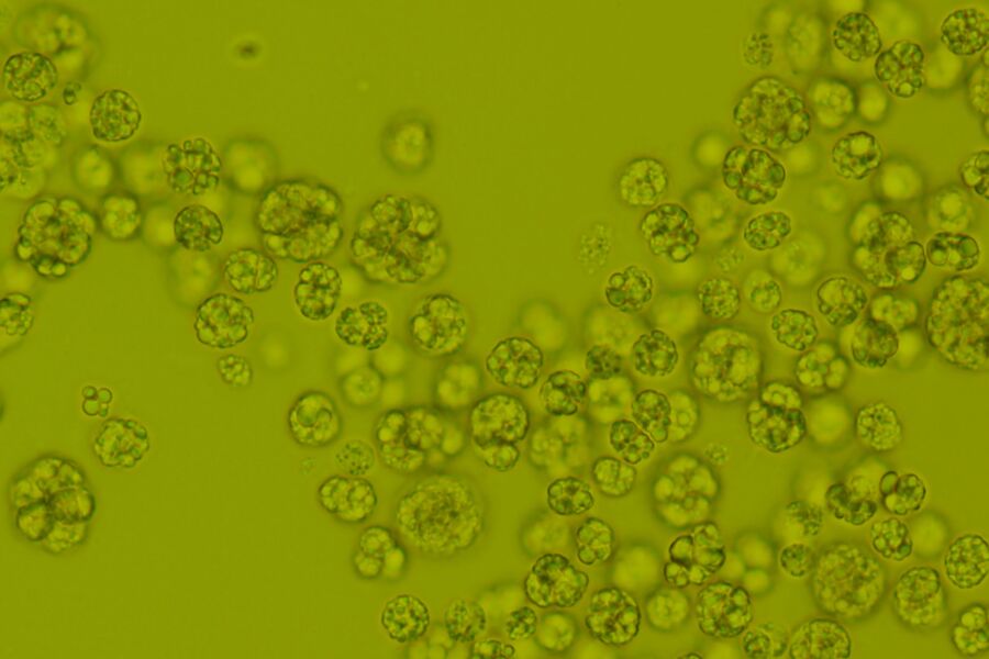 dsm-firmenich expands its advanced life’s® portfolio with life’sDHA® B54-0100 – a naturally potent DHA algal oil with exceptional sensory appeal