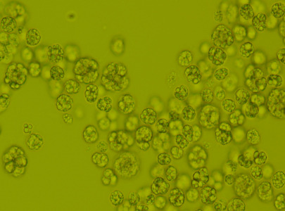 dsm-firmenich expands its advanced life’s® portfolio with life’sDHA® B54-0100 – a naturally potent DHA algal oil with exceptional sensory appeal